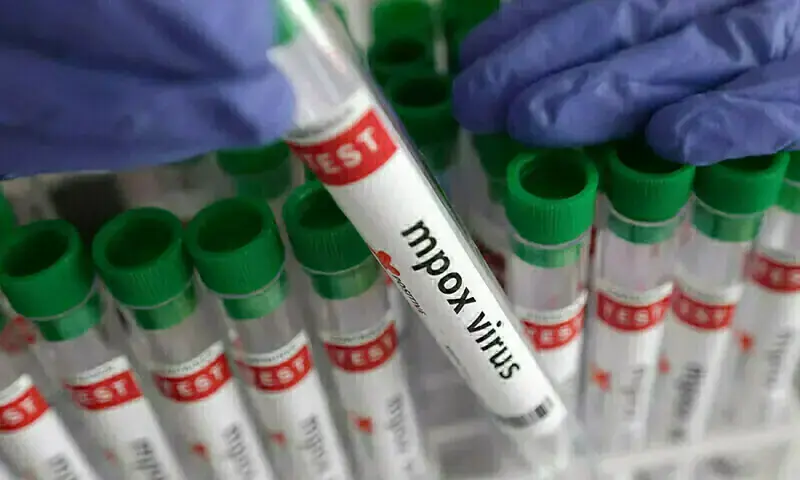 Mpox cases rise to 25 as two more test positive in Sindh